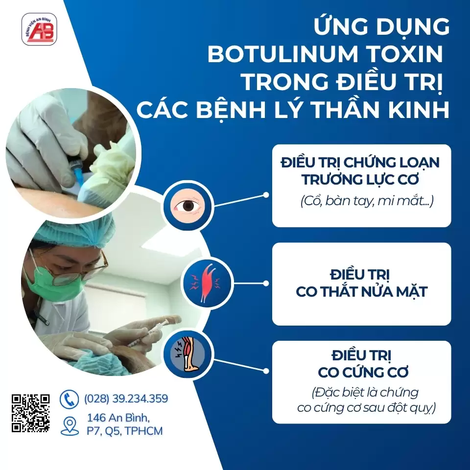 Tiêm Botulinum toxin – Giải pháp điều trị hiệu quả các rối loạn vận động thần kinh