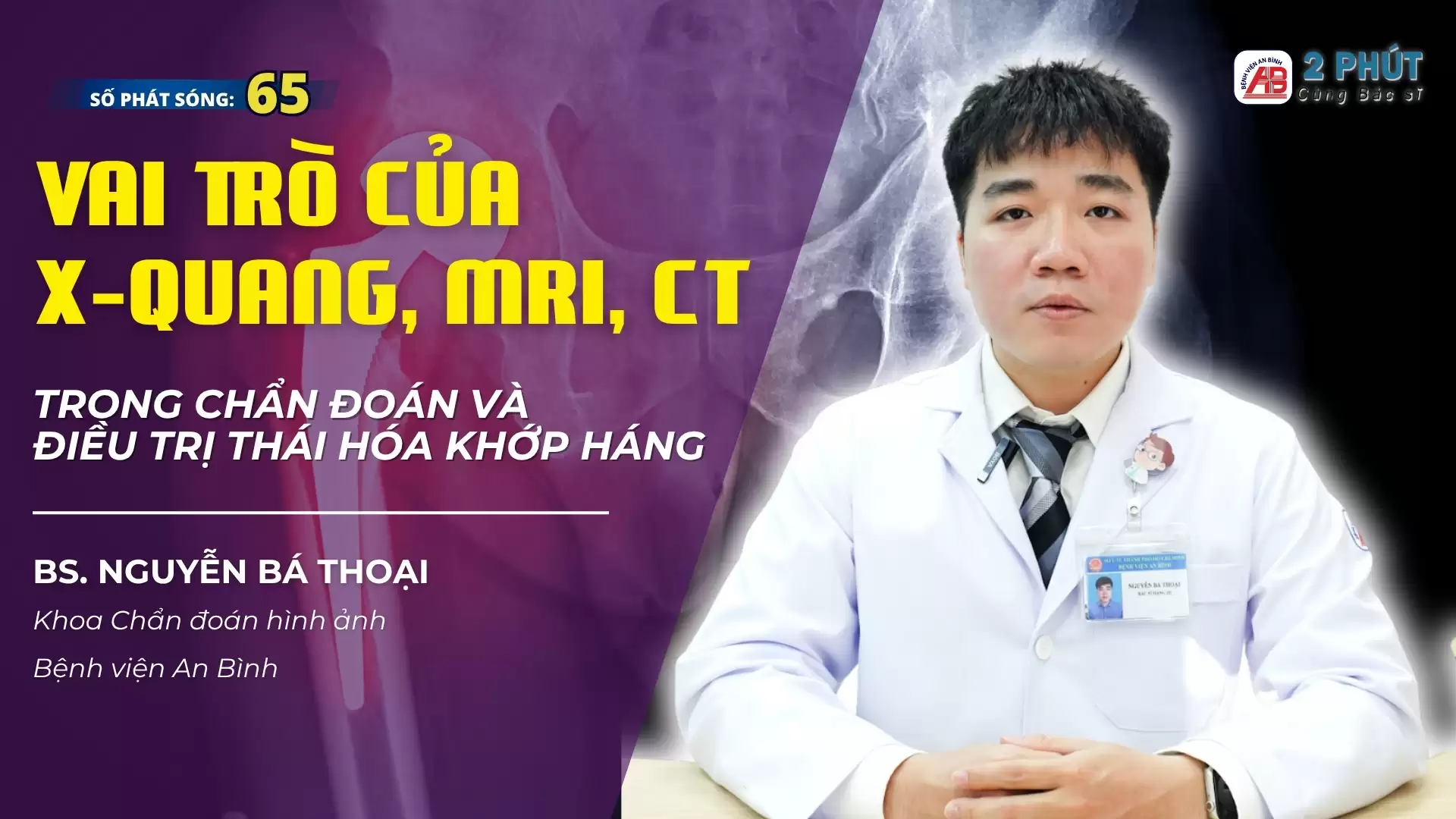 2 phút cùng Bác sĩ #65 – Thoái hóa khớp háng – Vai trò của X-Quang, CT, MRI