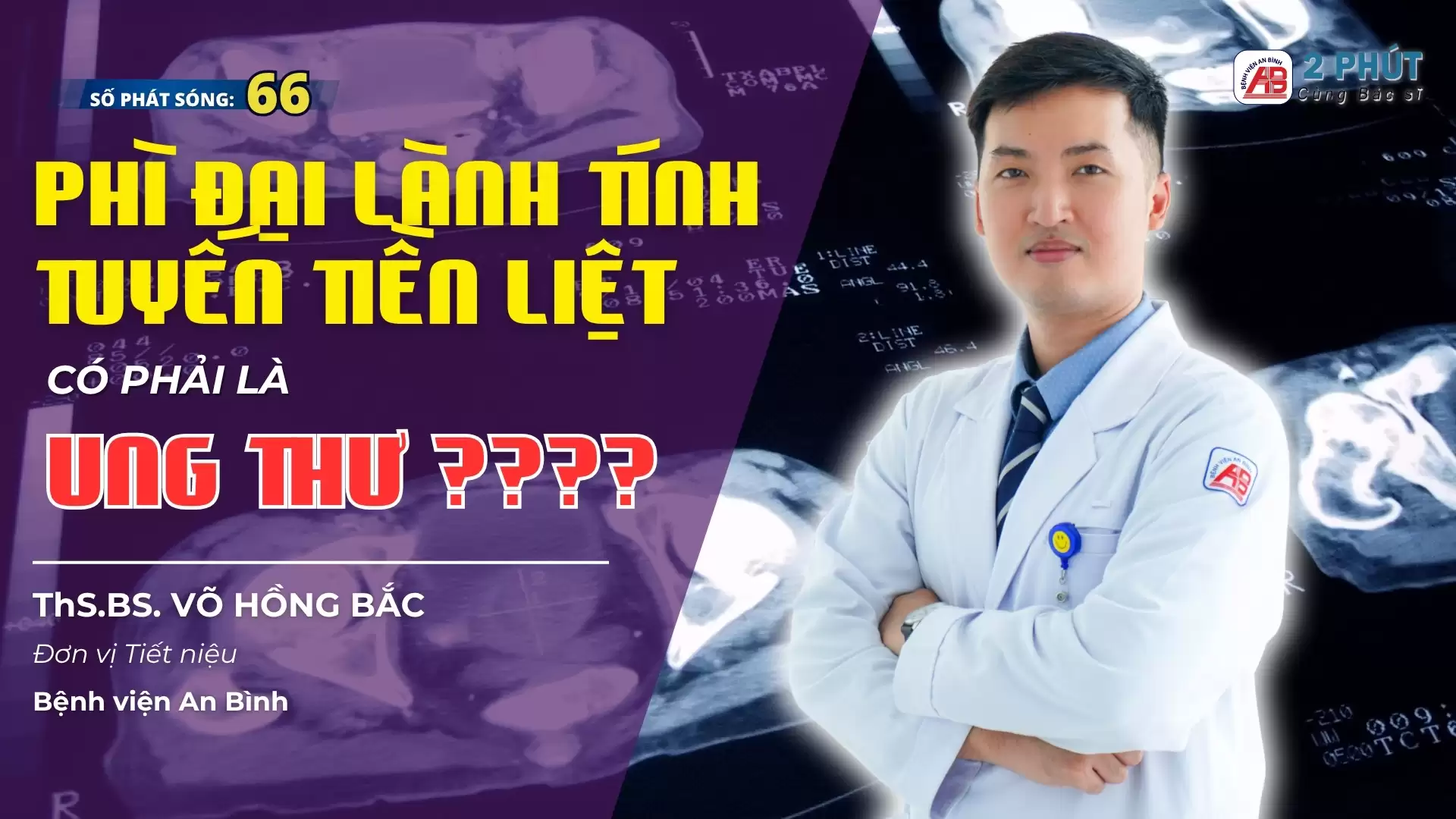 2 phút cùng Bác sĩ #66 – Tăng sinh lành tính tuyến tiền liệt