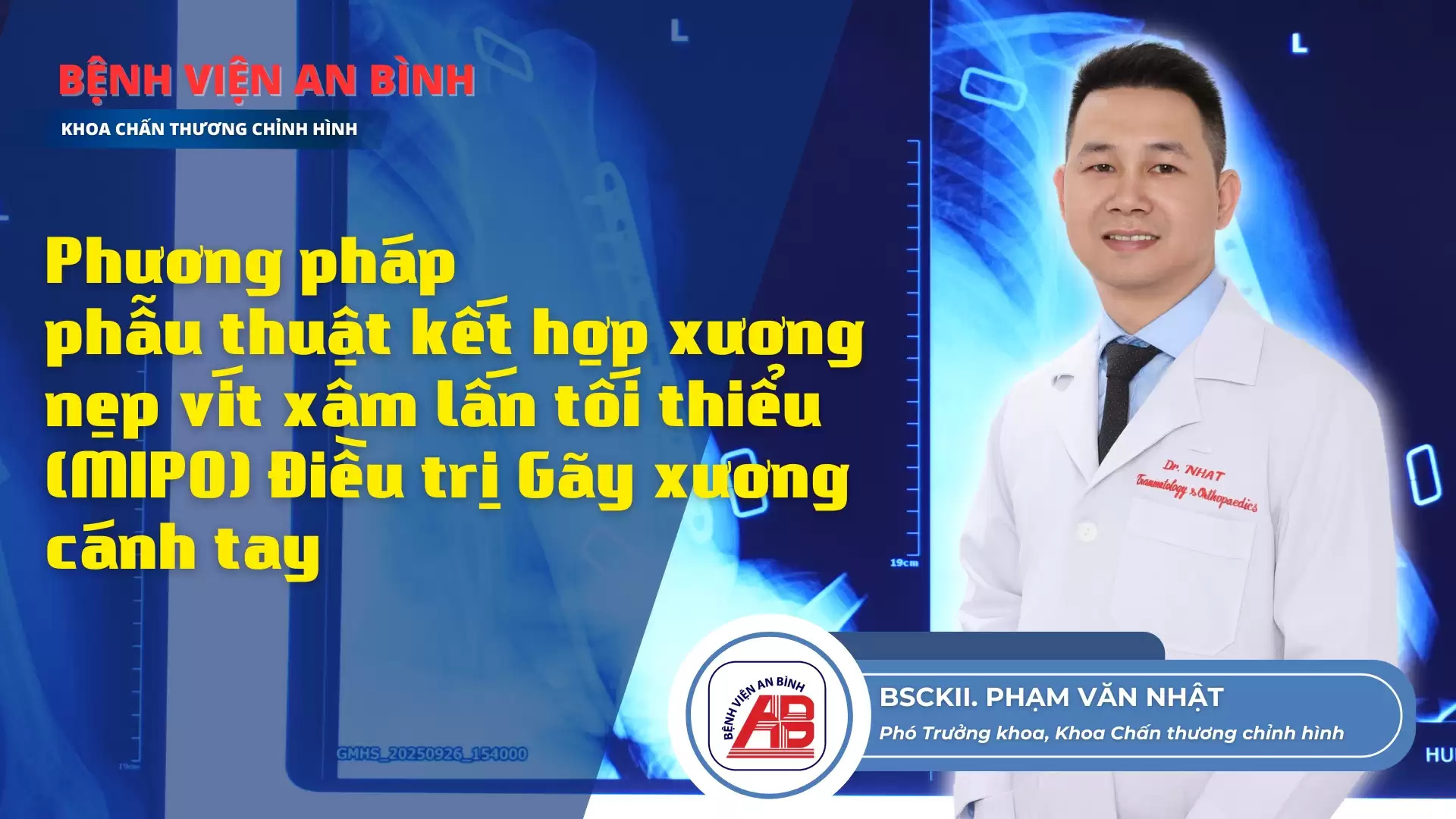 Phẫu thuật kết hợp xương nẹp vít xâm lấn tối thiểu (MIPO) – Giúp bệnh nhân phục hồi nhanh sau gãy xương cánh tay
