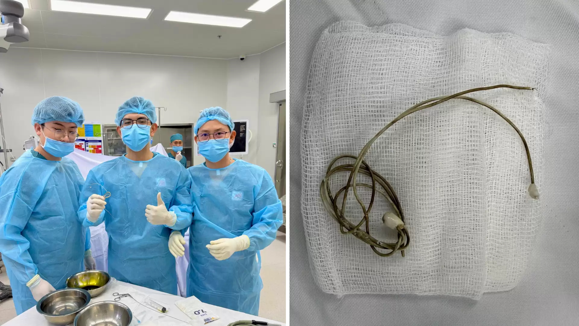 Bệnh viện An Bình xử lý thành công ca dị vật đường tiểu ở trẻ vị thành niên