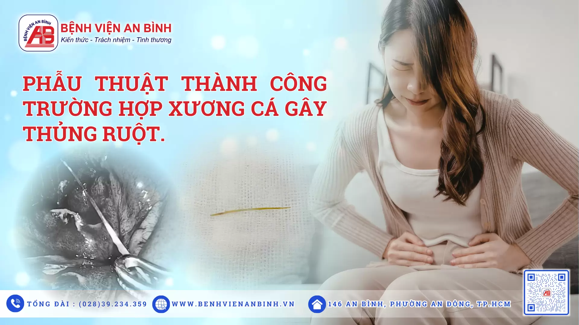 Phẫu thuật thành công trường hợp xương cá gây thủng ruột (12/3/2026)