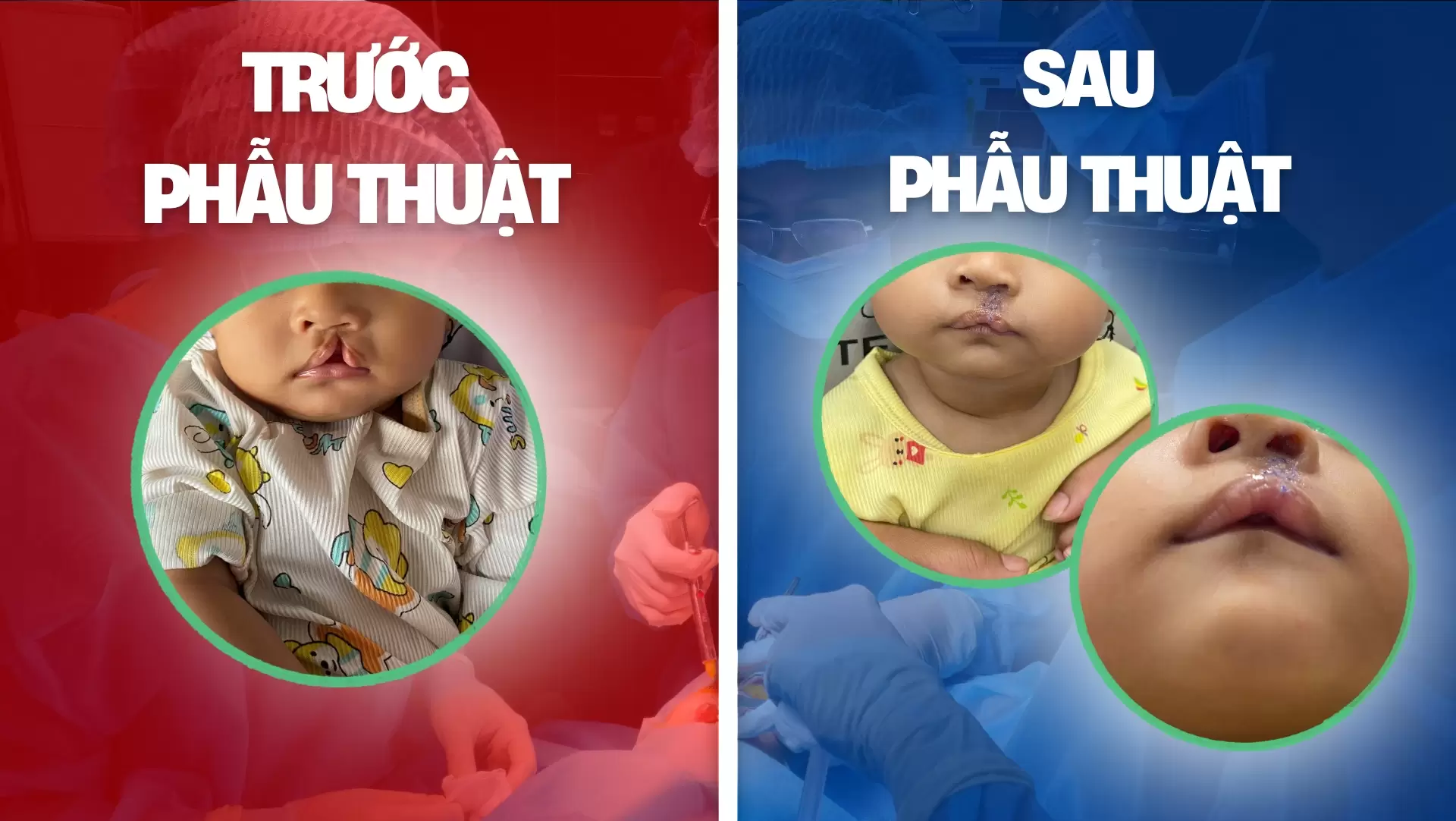 Hành trình tìm lại nụ cười cho trẻ thơ