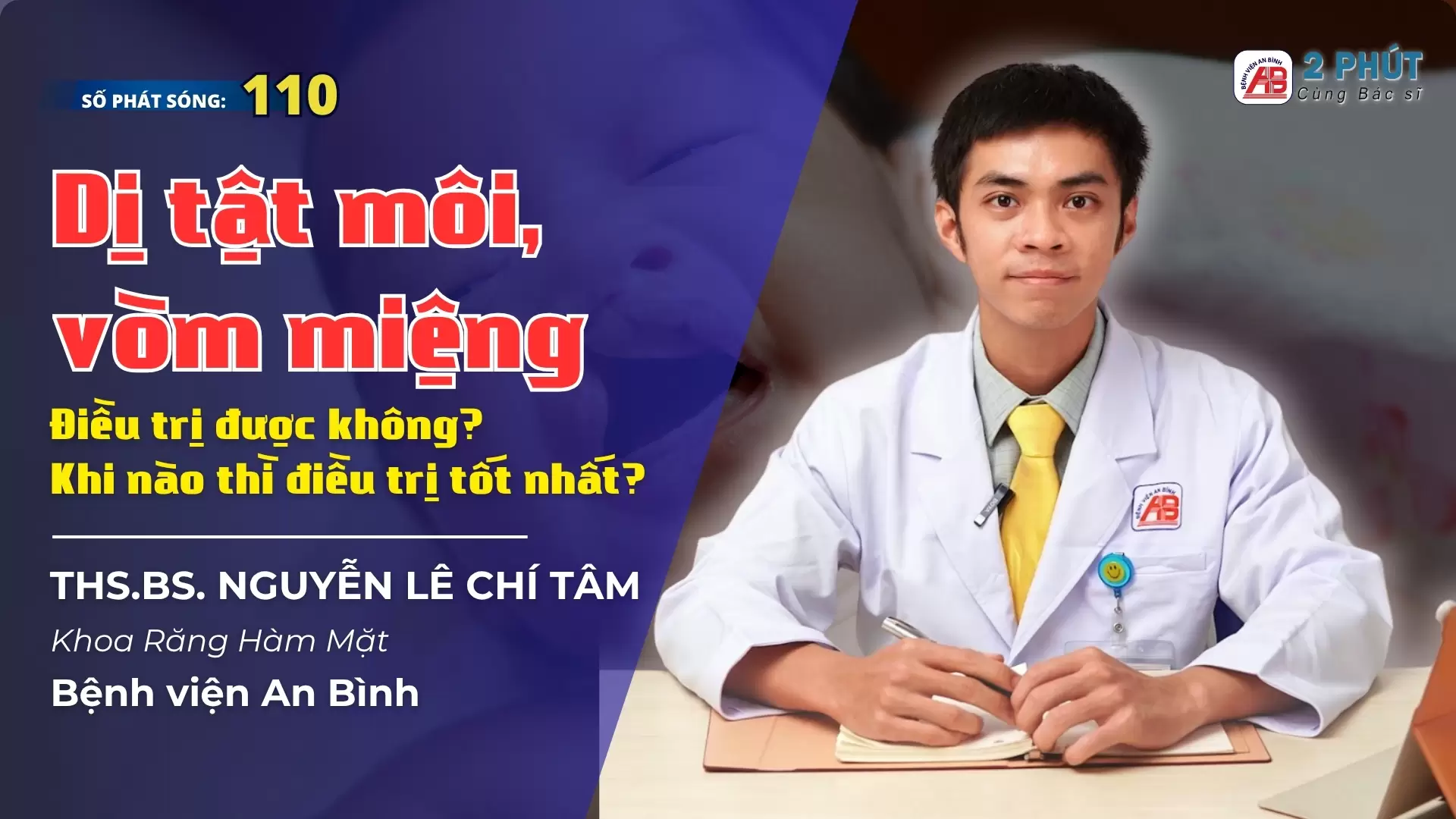 2pcbs#110 – Dị tật khe hở môi – vòm miệng ở trẻ em điều trị được không?