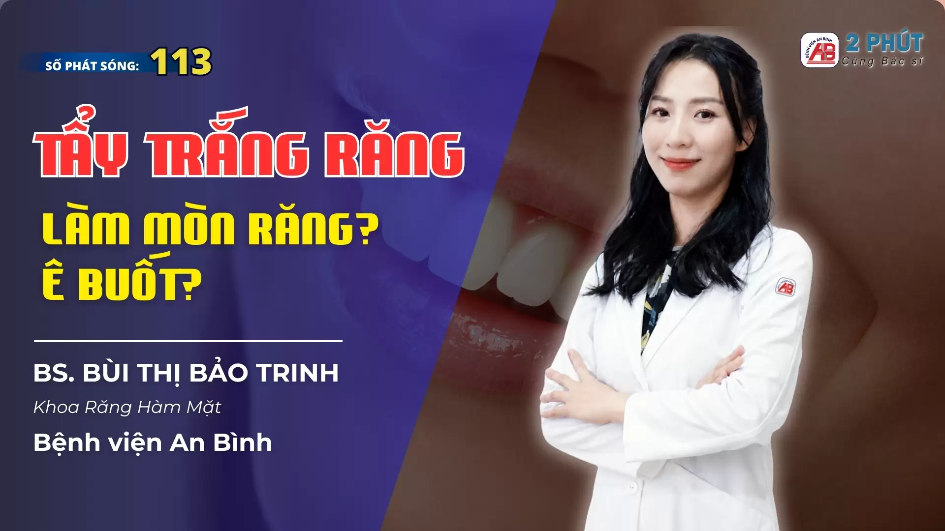 2pcbs #113 – Tẩy trắng răng có làm mòn răng không?