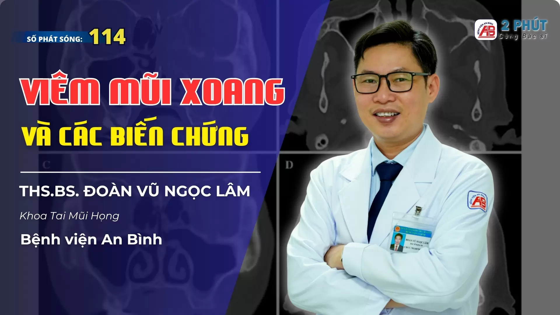 2pcbs #114 – Viêm mũi xoang và các biến chứng
