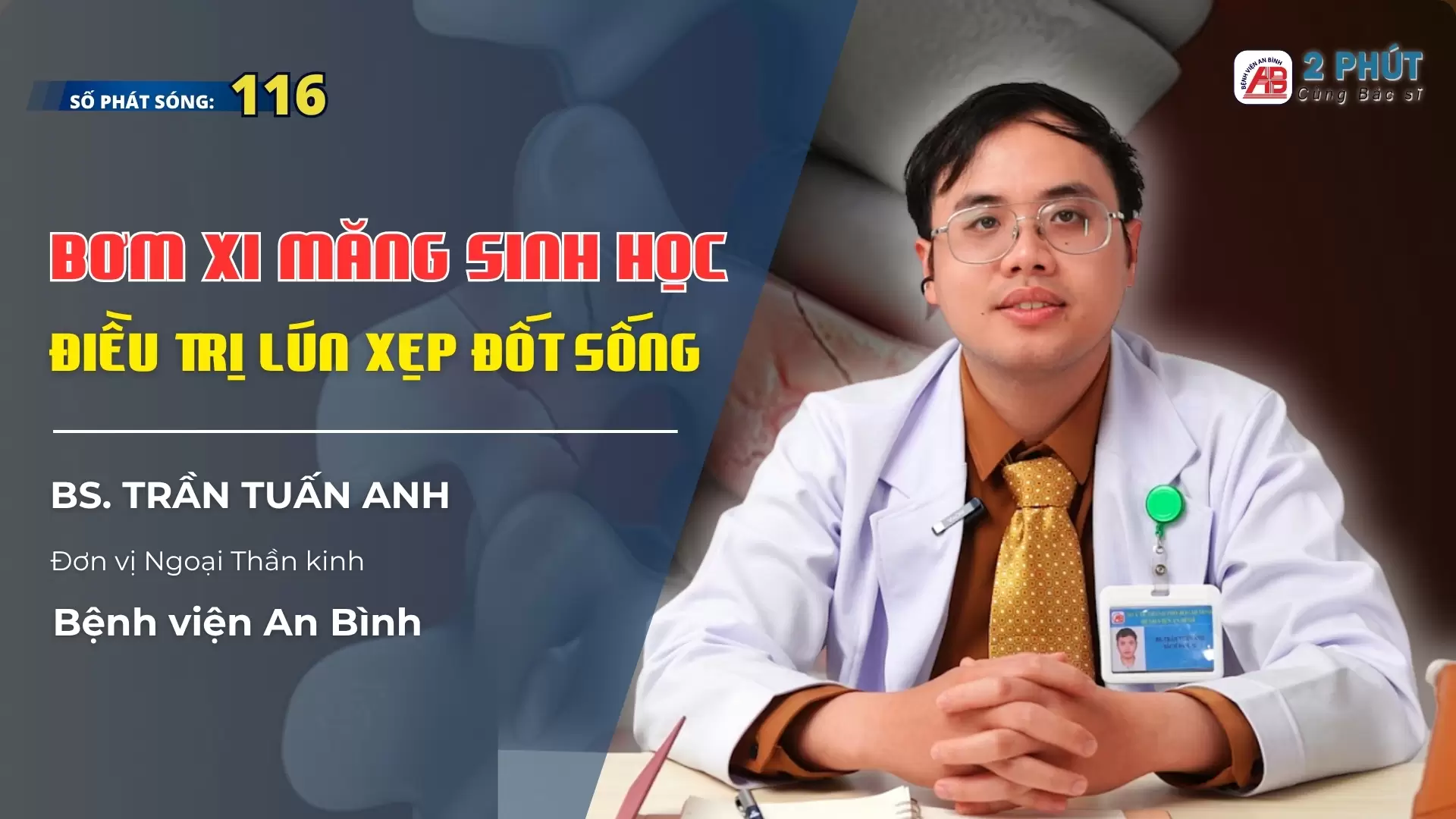 2pcbs #116 – Bơm xi măng sinh học – Điều trị gãy lún thân đốt sống
