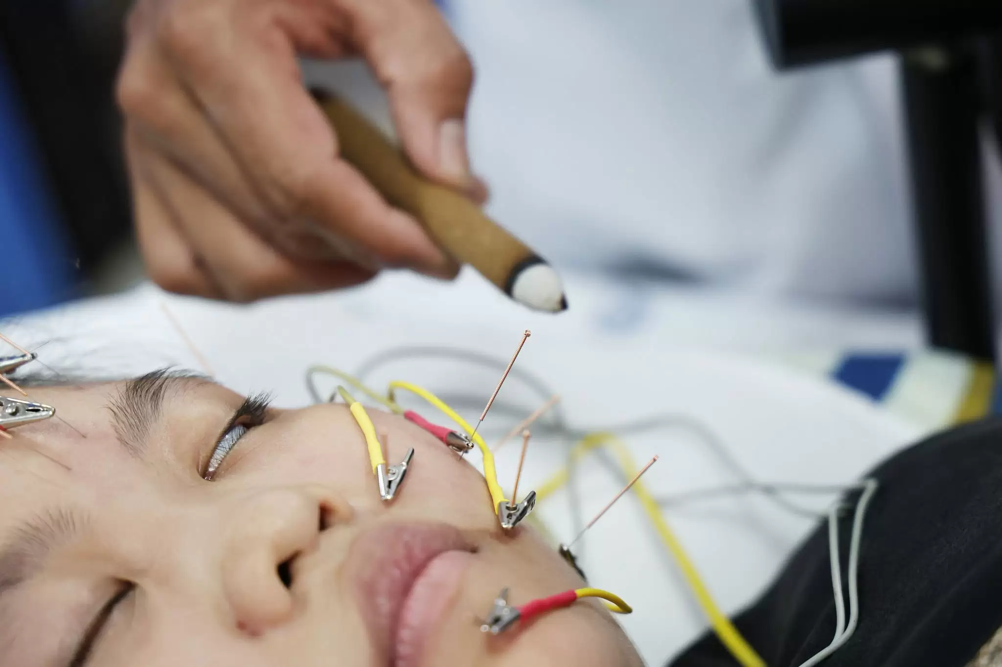 Y học cổ truyền: Một nền y học qua hàng nghìn năm vẫn được gìn giữ