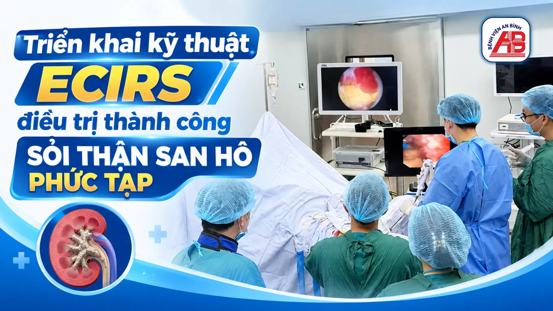 Triển khai kỹ thuật ECIRS điều trị thành công “Sỏi thận san hô phức tạp”