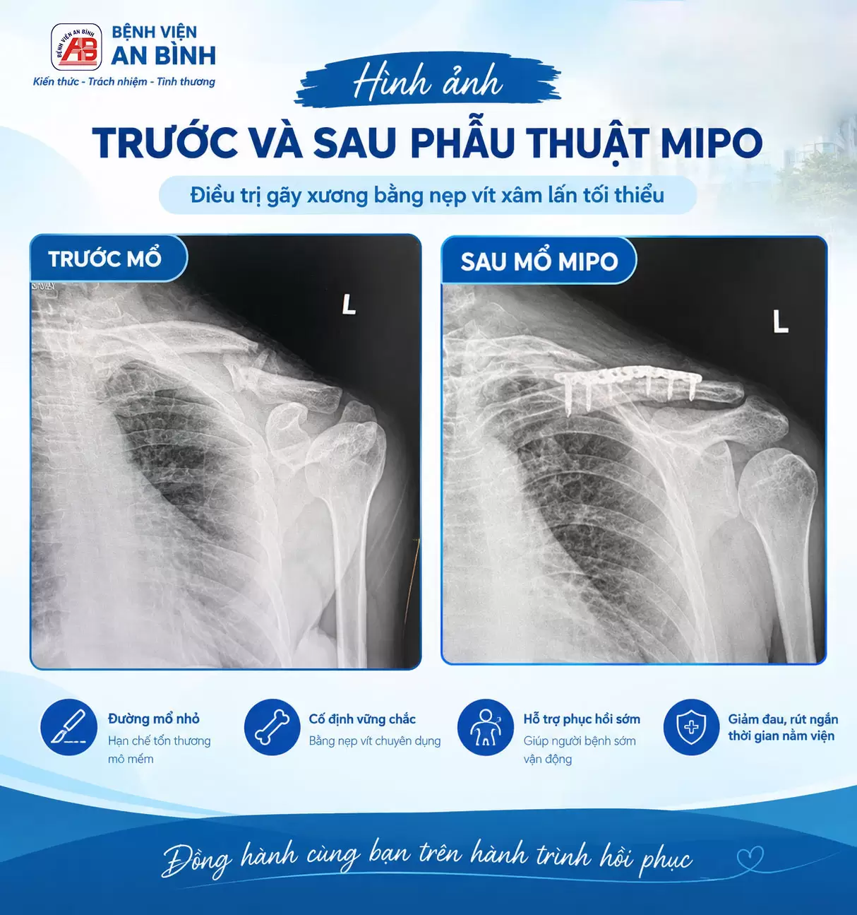 Sau 20 giờ phẫu thuật MIPO, nhân viên Bệnh viện An Bình tự tin cầm mic biểu diễn tại Hội nghị Khoa học Kỹ thuật